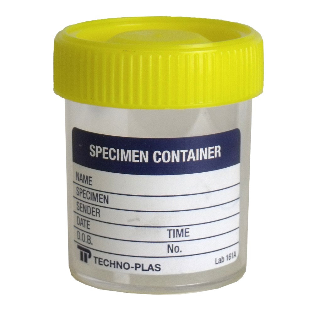 Specimen Jar Yellow Top (Labelled)